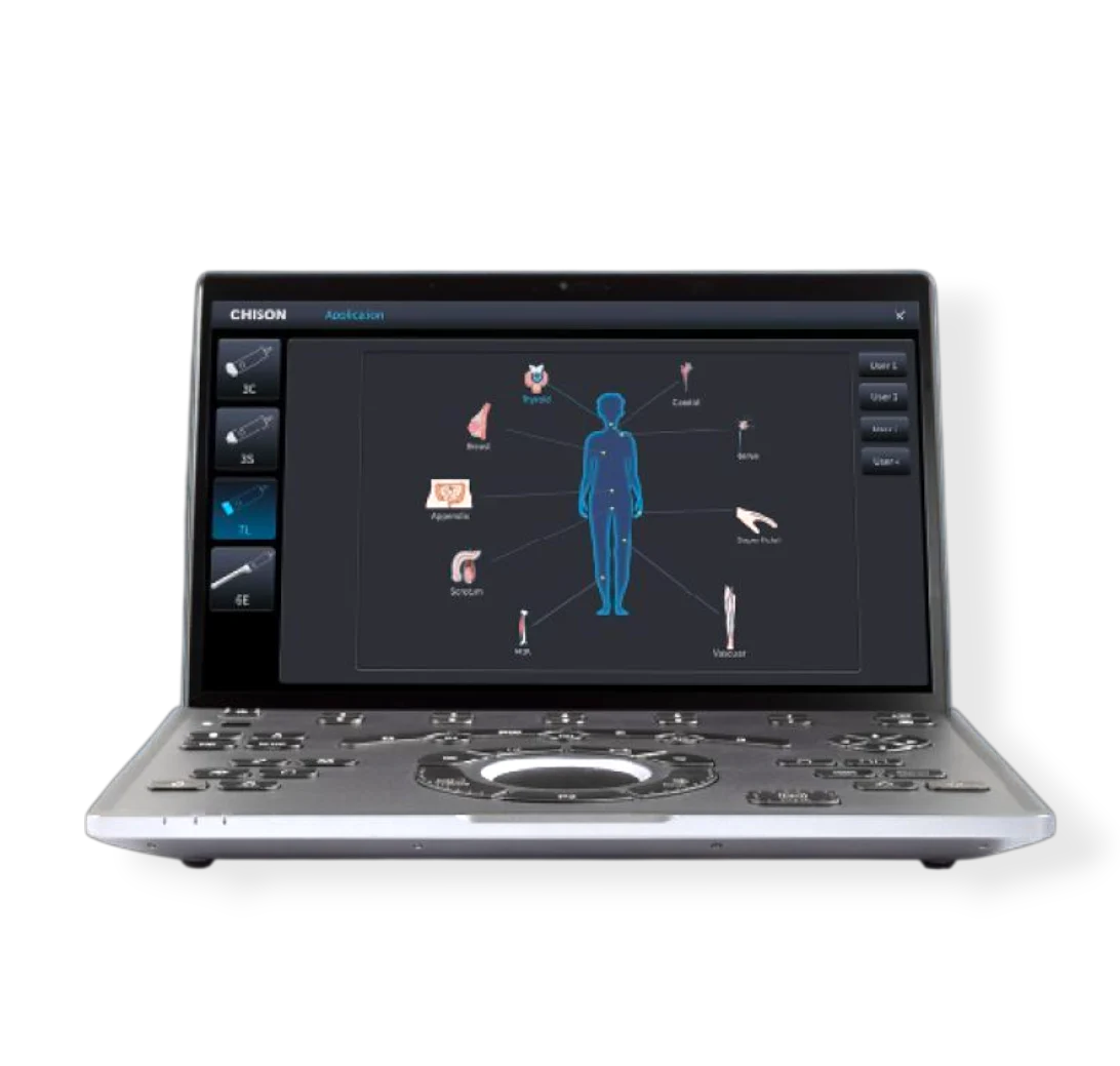 CHISON SonoAir 70 Ultraschall Leupamed