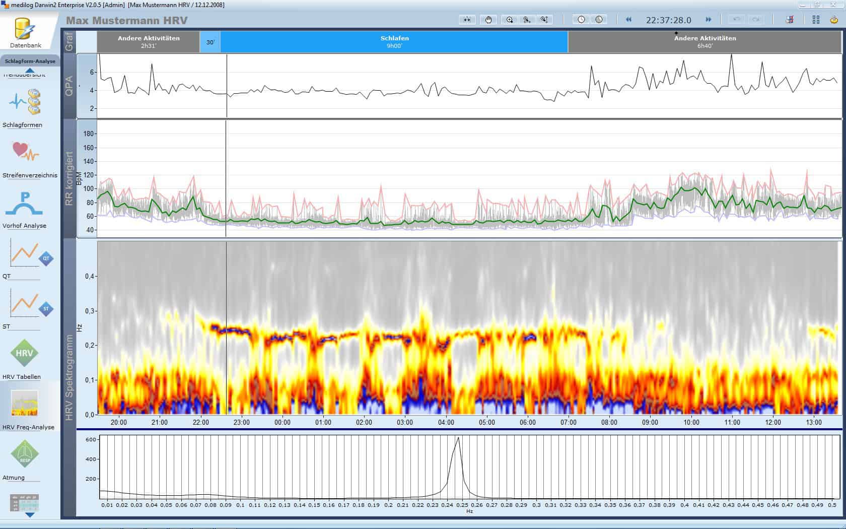 Langzeit EKG medilot Darwin professional Sofware Leupamed